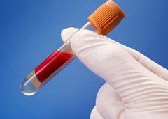 南宫ng28注册平台入口-南宫28在线登录-南宫28圈电脑版-南宫28在线注册网站-南宫集团加拿大28-南宫28相信品牌的力量链接-南宫28NG国际-南宫ng娱乐app下载制冷医药血浆冷库设计优势